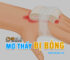 Ngủ mơ thấy bị bỏng đánh lô đề, điềm báo như thế nào ?