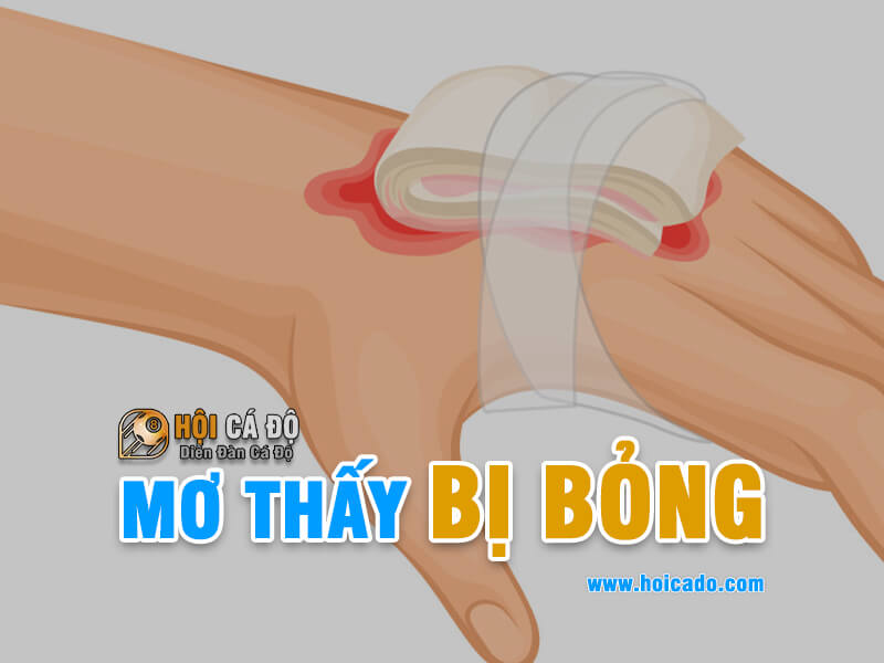Ngủ mơ thấy bị bỏng đánh con gì ?