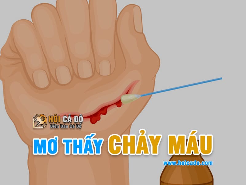 Mơ thấy chảy máu đánh lô đề số nào ?